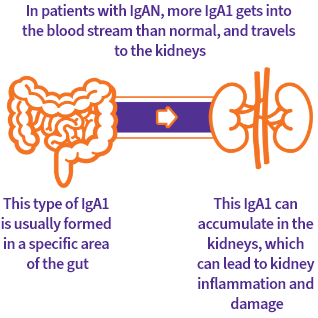Visual representation of IgA1 antibody produced in the gut causing IgA Nephropathy