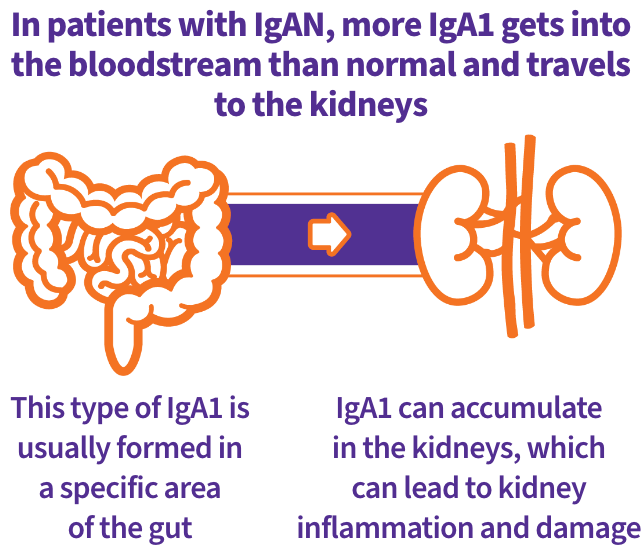 What may cause IgAN